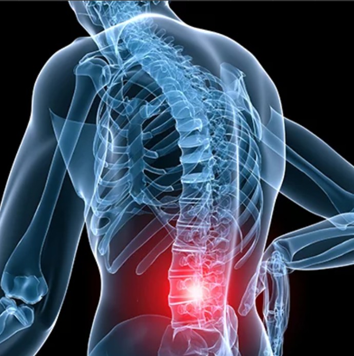 Spinal Trauma