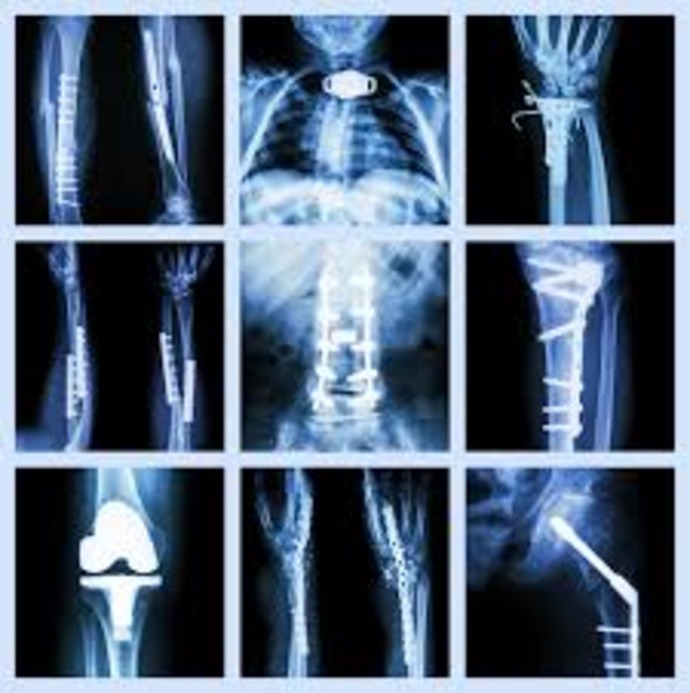 Orthopedic Trauma